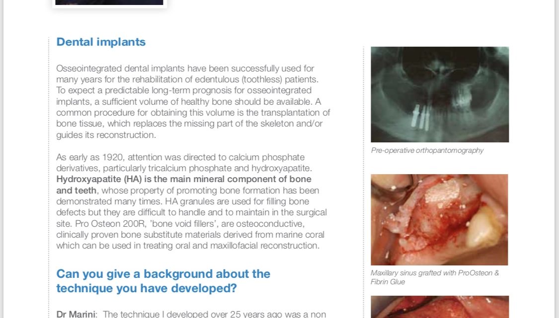 Put a smile Upon Your Face. The role of hydroxyapatite in bone reconstruction over the last 25 years