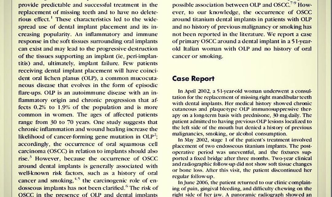 Peri-implant Primary Squamous Cell Carcinoma: A Case Report With 5 Years’ Follow-Up