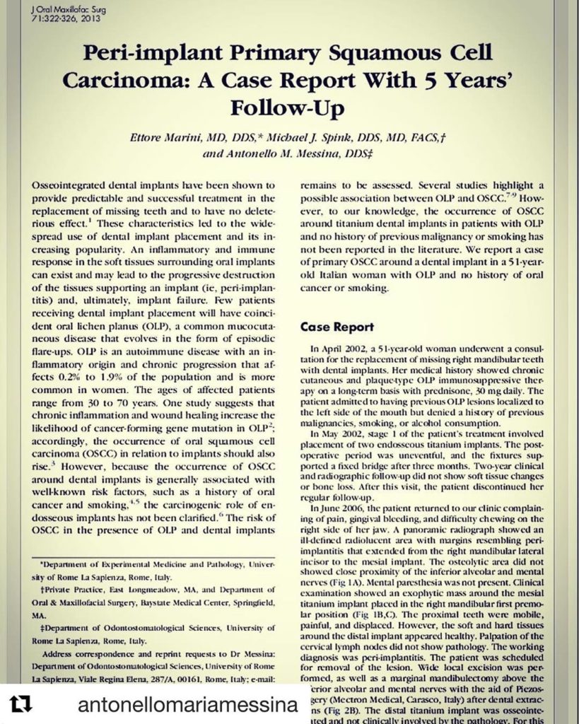 Peri-implant Primary Squamous Cell Carcinoma: A Case Report With 5 Years' Follow-Up. Marini E, Spink MJ, Messina AM.



Journal of Oral & Maxillofacial Surgery