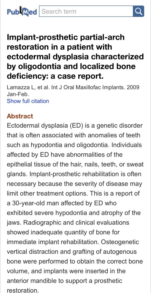 Implant-prosthetic partial-arch restoration in a patient with ectodermal dysplasia