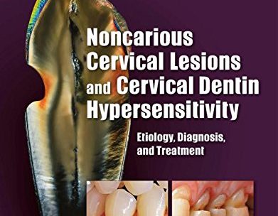 Noncarious cervical lesions and Cervical dentin hypersensitivity