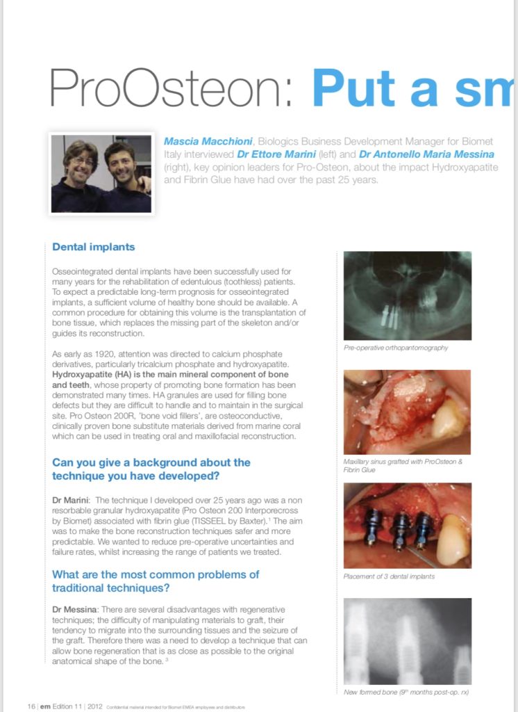 Put a smile Upon Your Face. The role of hydroxyapatite in bone reconstruction over the last 25 years