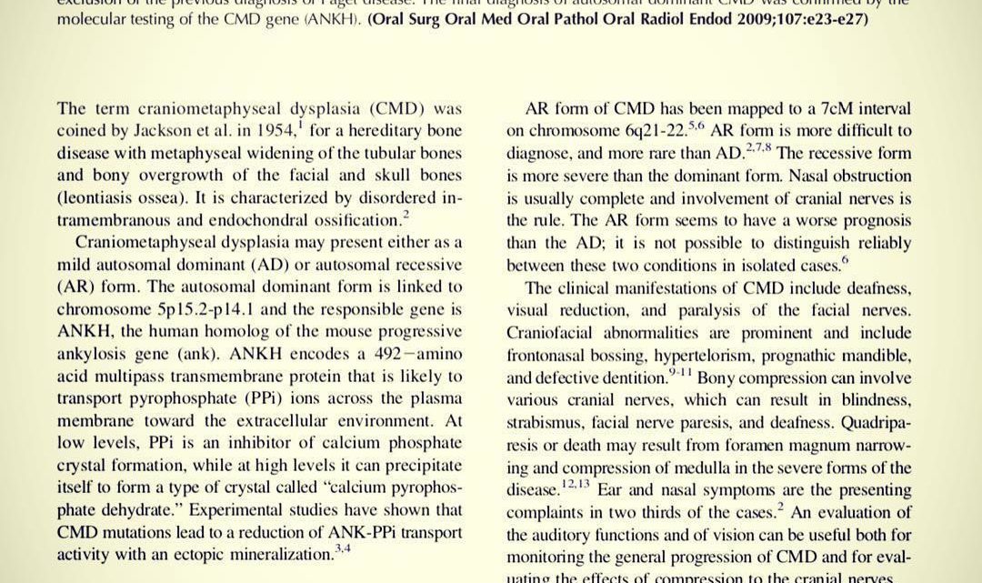 Craniometaphyseal dysplasia: a case report