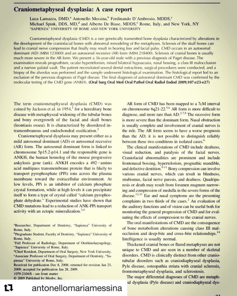 Craniometaphyseal dysplasia: a case report